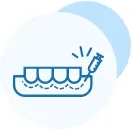 درمان ریشه ترمیم دندان