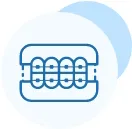 ارتودنسی ثابت و متحرک