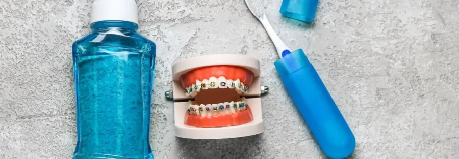 بوی بد دهان در زمان ارتودنسی