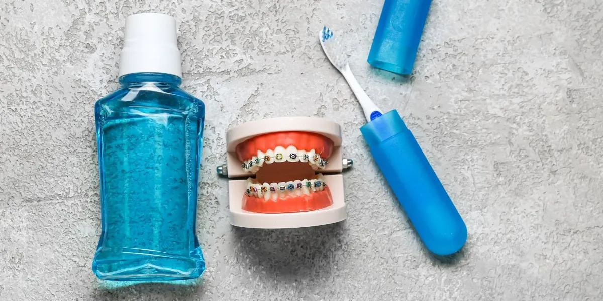 بوی بد دهان در زمان ارتودنسی