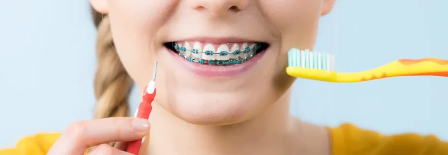 مسواک ارتودنسی چیست؟ نحوه استفاده + قیمت