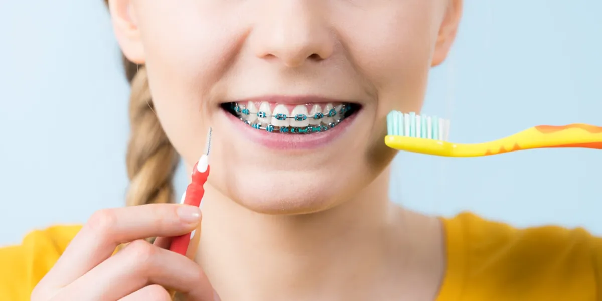 مسواک ارتودنسی چیست؟ نحوه استفاده + قیمت